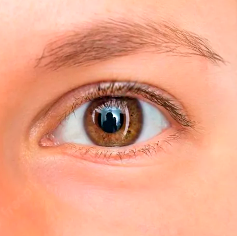 Depois da Blefaroplástia